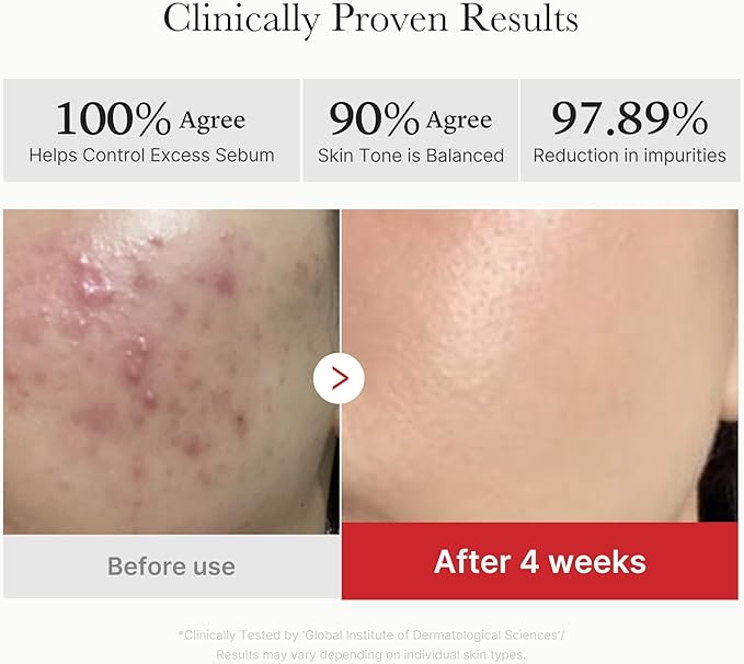 Medicube Red Succinic Acid Panthenol Facial Peeling Pads - Exfoliating Toner Pads for Breakout-Prone Skin with Niacinamide, AHA, BHA, and Soothing Panthenol - Non-Comedogenic-GlimoraGlow