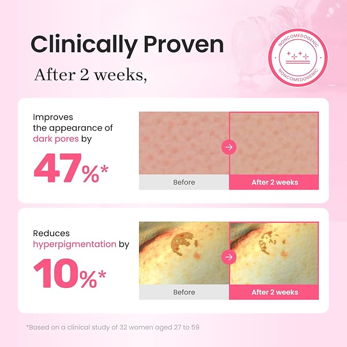 CNP PDRN + Tranexamic Acid Serum 15%, Pink Toning Skin Booster, Niacinamide & Micro-spicules, for Glass Skin, Korean Skin Care, 1. 18 fl. oz.-GlimoraGlow