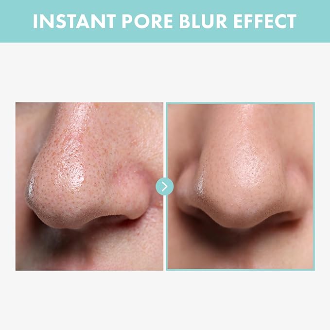 Pore Tightening Serum, Instantly Reduces Pores, Smooths Skin & Strengthens Barrier, Formulated With Niacinamide & Allantoin, Pore Minimizer For Face, Korean Skin Care, 30ml, 1.01 fl. oz.-GlimoraGlow