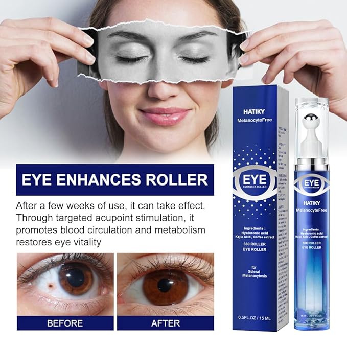 Caffeine Eye Cream with 360° Eye roller for Puffy Eyes -Under Eye Cream for Dark Circles and Puffiness - 5% Caffeine Eye Serum Reduce Wrinkles, Fine Lines and Under Eye Bags-GlimoraGlow