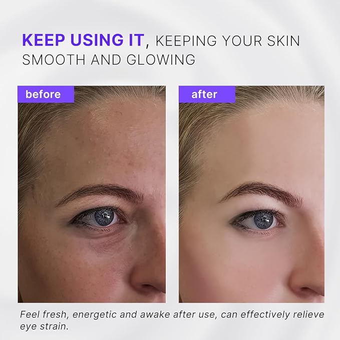 2-in-1 Eye Cream Applicator and Ice Roller, Face Massager Tool for Puffiness, Eye Bags, Muscle Ache-GlimoraGlow