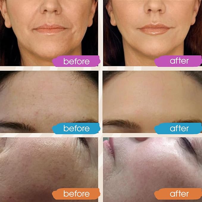 Vitamin C Face Serum, Hydrating Vitamin C Serum for Face with Hyaluronic Acid, Suitable For All Skin Types, Targets the Appearance of Dull Spots 2oz-GlimoraGlow