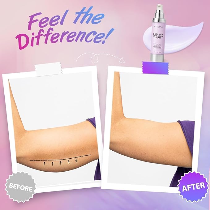 VASSOUL Lift and Firm Arm Cream : Skin Tightening Cream for Body - Firms Loose Skin, Reduces Cellulite on Arms, Thighs & Butt – 100ML-GlimoraGlow