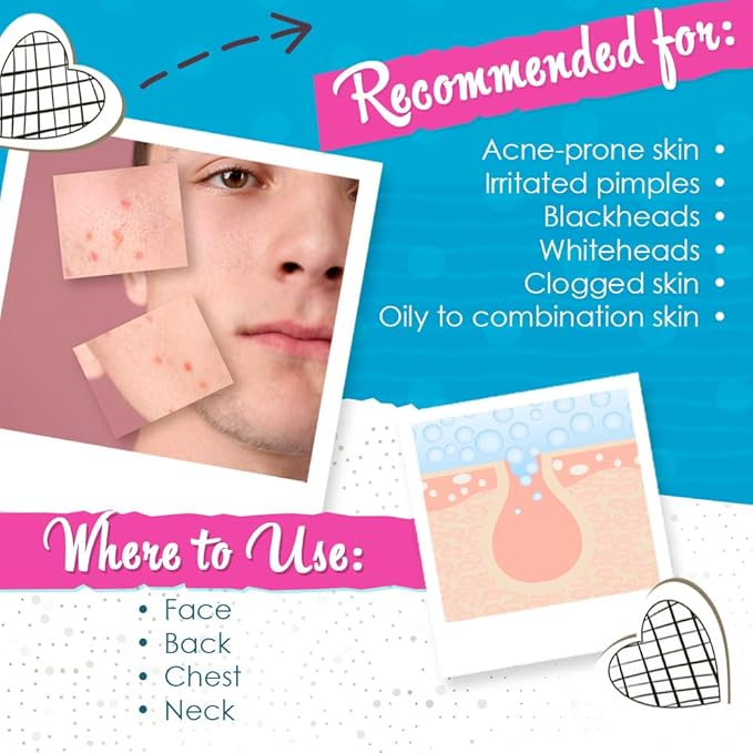 Bye Bye Blemish Acne Drying Lotion, On-the-Spot Pimple Treatment, Reduce Pimples Overnight, Beauty Skincare Essential - 1oz. (2-Pack)-GlimoraGlow