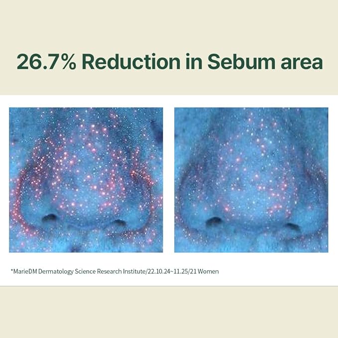 Pyunkang Yul Calming Moisture Serum for Strong Daily Moisturizing Power, Skin Revival & Soothing Care with Centella Asiatica, Tea Tree, 5 Hyaluronic Acids, Ceramide |-GlimoraGlow