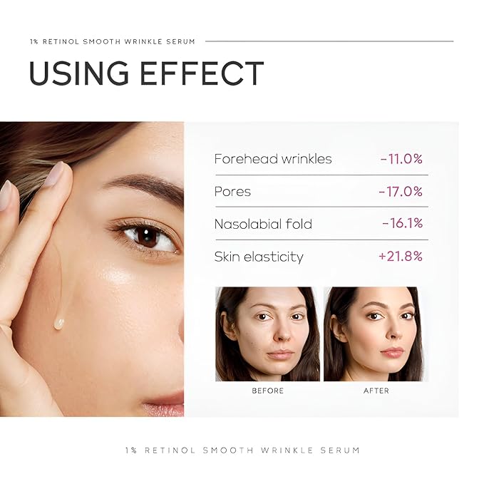 1% Retinol Serum for Face, Facial Serums for Anti Aging with Retinol, Niacinamide & Vitamin E for Fine Lines, Wrinkles & Dark Spots, Daily Skincare to Smooth & Firm Skin, 1.06 fl. oz, Pack of 2-GlimoraGlow