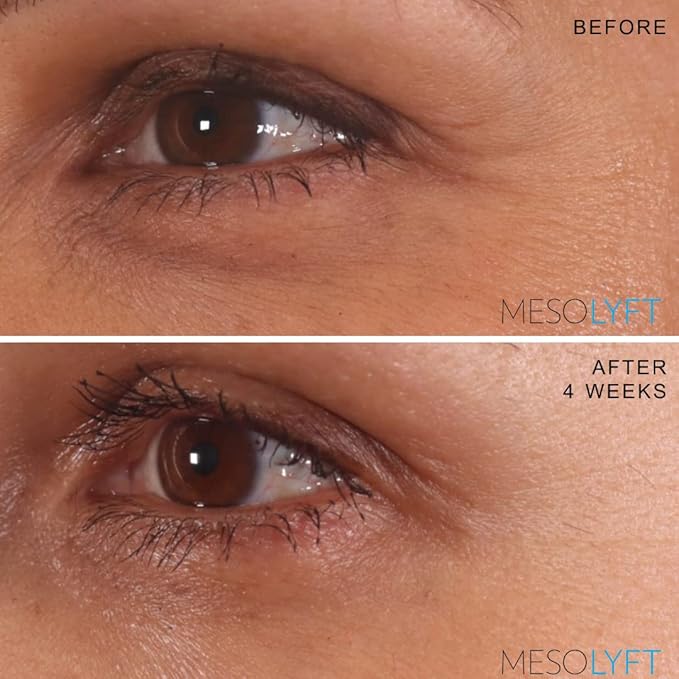 Anti-Aging Serum with Neck & Eyes Combo Skincare Face Serum Reduce Signs of Aging Roller for Face An Effective Treatment for Neck and Eyes-GlimoraGlow