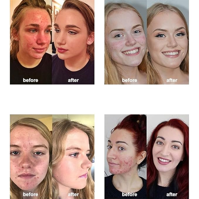 2 Pack PHOERA Foundation 104 Buff Beige Makeup,Full Coverage Foundation for Women and Girls-GlimoraGlow