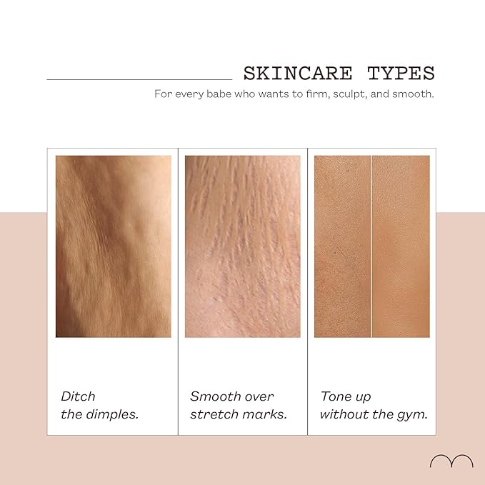 frank body Firming Body Cream | Caffeine & BODY 3 COMPLEX™ to Help Reduce the Look of Dimpled Skin & Stretch Marks | Vegan, Cruelty-Free, Hyper-Hydrating | 200ml-GlimoraGlow