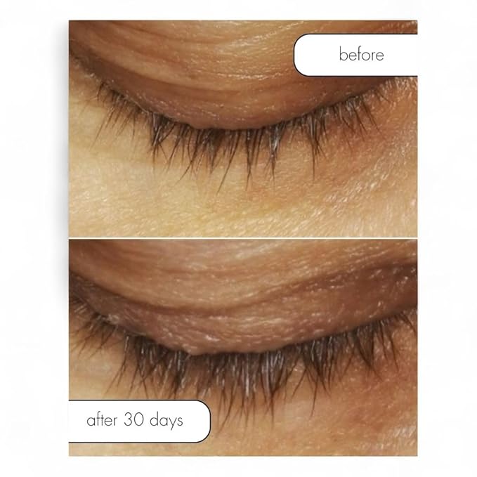 Serious Skincare Lash Bath & Conditioner - Double Action Eye Makeup Remover - Oil Free - Enhancing Peptides Promotes Eyelash Growth - Clover Flower - Effortlessly Removes Waterproof Mascara - 4 oz.-GlimoraGlow