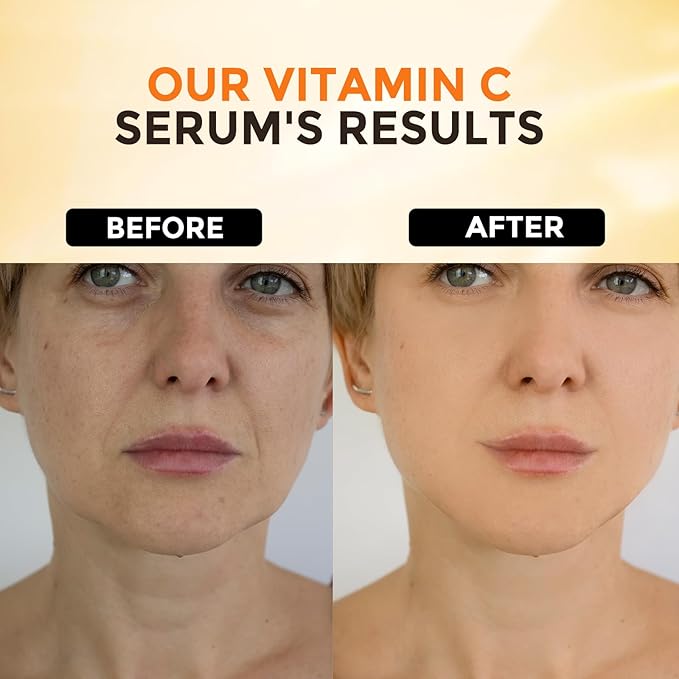 2 Packs Vitamin C Serum for Face –Anti Aging Face & Eye Serum, Hyaluronic Acid, Reduce Fine Lines, Dark Spots and Wrinkle-GlimoraGlow