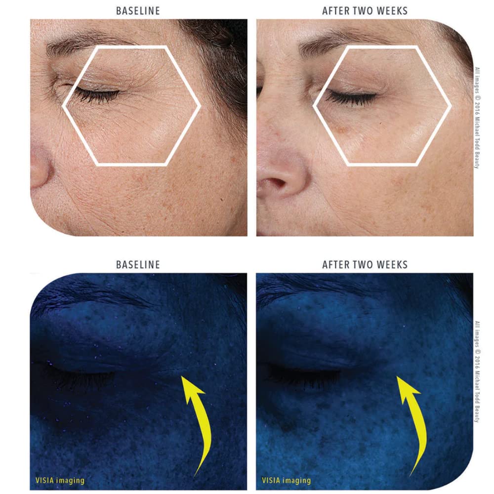 MICHAEL TODD Beauty KNU Cream – Face Lifting, Brightening & Tightening Cream – For Moisturizing & Rejuvenating – With Bakuchiol, Peptides & Snail Secretion – For All Skin Types – 1.68 fl oz/50 mL-GlimoraGlow