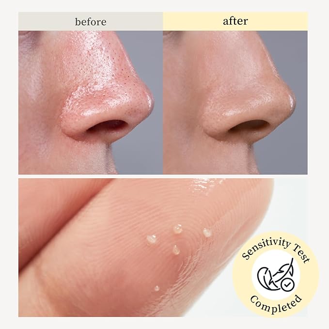 NOONI Facial Cleanser - Snow Aqua 0 LHA Toning Cleansing Oil | Makeup Blackhead Remover, Pore Control, Glass Skin, Help Control Sebum, Revitalizing, Moisturizing, Korean Skin Care, 6.76 Fl Oz (200 ml)-GlimoraGlow