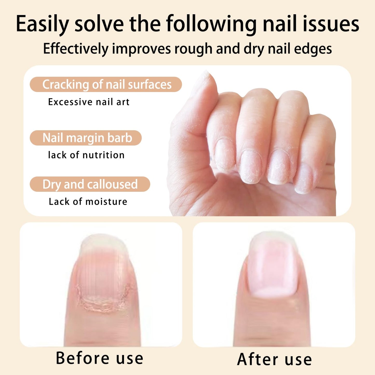 12pcs Cuticle Oil Pen Sweet Almond Nail Growth Serum and Repair Treatment Hydrating Oil for Dry Cuticles and Skin Cuticle Buddy Revitalize Nails with Radiant Cosmetics' Nail Growth Oil-GlimoraGlow