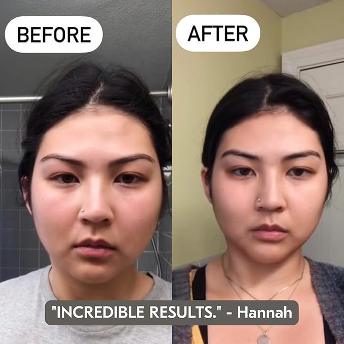 Mount Lai Rose Quartz Gua Sha Facial Tools, Pink Quartz Gua Sha Facial Tools Set and Roller, Guasha Tool for Face to Relieve Muscle Tension and Reduce Puffiness, Anti Aging Skin Care Sets for Women-GlimoraGlow