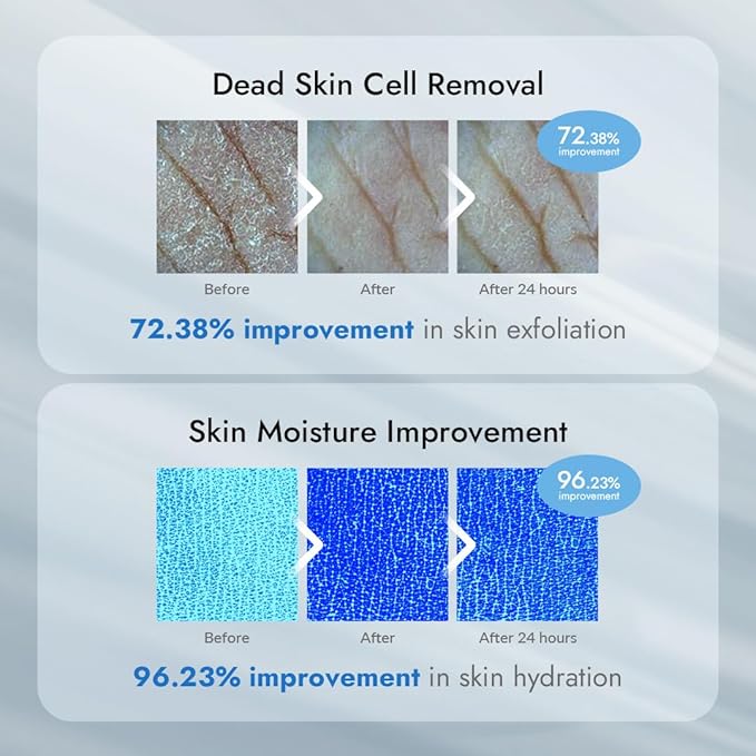 V11FACTORY AHA 12% Glycolic Acid Body Lotion – Korean Exfoliating & Hydrating Body Cream with Hyaluronic Acid & Collagen – Unscented, Paraben-Free Skin Smoothing Moisturizer, 10.6 oz-GlimoraGlow