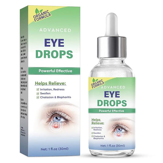 Stye Eye Treatment, Stye Eye Drops Serum for Styes Chalazion and Blepharitis, Chalazion Remover Fast Relief, Restore Healthier Eye Skin, 30ml-GlimoraGlow