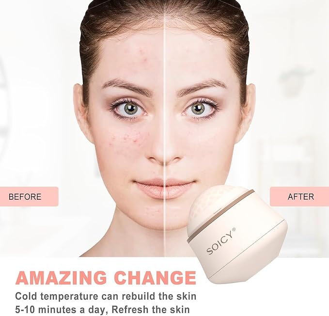 OPENDGO Facial Ice Roller 360° Rotating Massager Roller Ball Cooling Face Ice Roller for Reduce Puffiness and Relief Migraine, Pain,Ice Face Eye Massage Roller, Skin Care Tools-GlimoraGlow