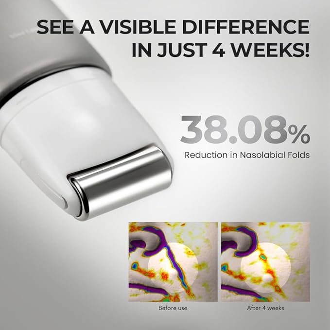 [SKIN&LAB] Retinol Lifting Roller Cream with Massage applicator, Vegan Anti Aging Face and Neck Cream for Reduce Wrinkles and Fine Line, For Face, Neck, Décolleté Wrinkle Care, 1.69 fl. oz.-GlimoraGlow