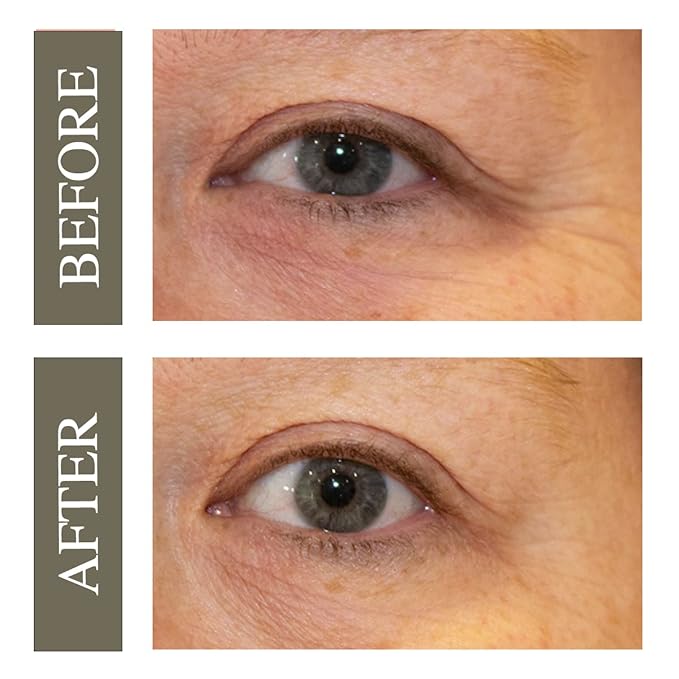 Hey Honey Open Your Eyes Lifting Eye Serum | Under Eye Cream for Dark Circles & Puffiness | Around The Eyes Hydration | Suitable For Sensitive Aging Skin | Delivers A Bright Rested look | 0.5 oz.-GlimoraGlow