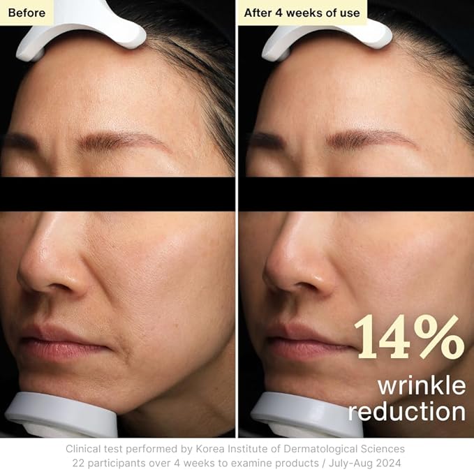 Rothea Resilience Cream, Anti-Aging with Bakuchiol 10,000ppm (Natural Retinol Alternative), Face Moisturizer, Neck Cream with Collagen, Ceramides, Peptides, Niacinamide, Korean Skin Care, 1.7 oz-GlimoraGlow