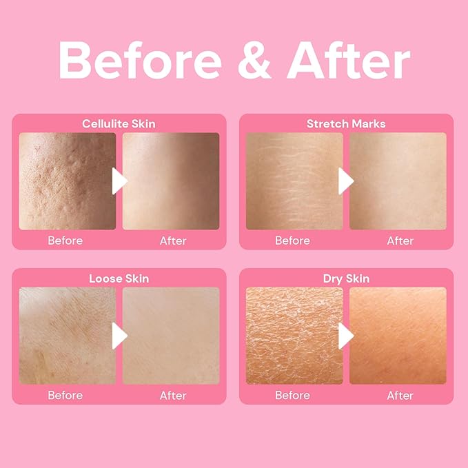 Enaskin Naturals Anti Cellulite Cream: Skin Firming and Tightening Lotion for Booty, Legs & Belly - Lifting Body Mask for Women Loose Skin, Lift & Firm Moisturizing Bum Bum Care-GlimoraGlow