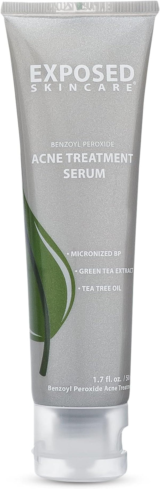 Exposed Skin Care Acne Treatment Serum Step 3 – Quickly Reduces Pimple Size and Redness - 12 Hour Spot Treatment - 3.5% Benzoyl Peroxide, Natural Green Tea & Tea Tree Oil-GlimoraGlow