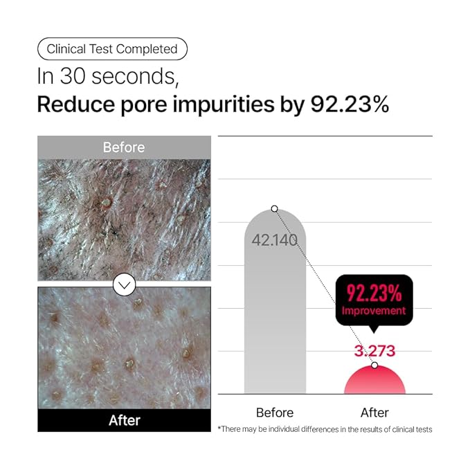 Parnell Aha Omija Ceramic Cleansing Oil 200ml / 6.76 fl.oz | blackhead melting, korean facial cleanser, korean skincare-GlimoraGlow