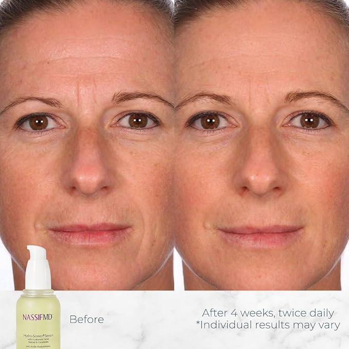 NassifMD Hydro-Screen Hydrating Serum with Hyaluronic Acid & Ceramides – Lightweight, Fast-Absorbing Formula for Smooth, Plump, Moisturized Skin – Ideal for Dry or Sensitive Skin-GlimoraGlow