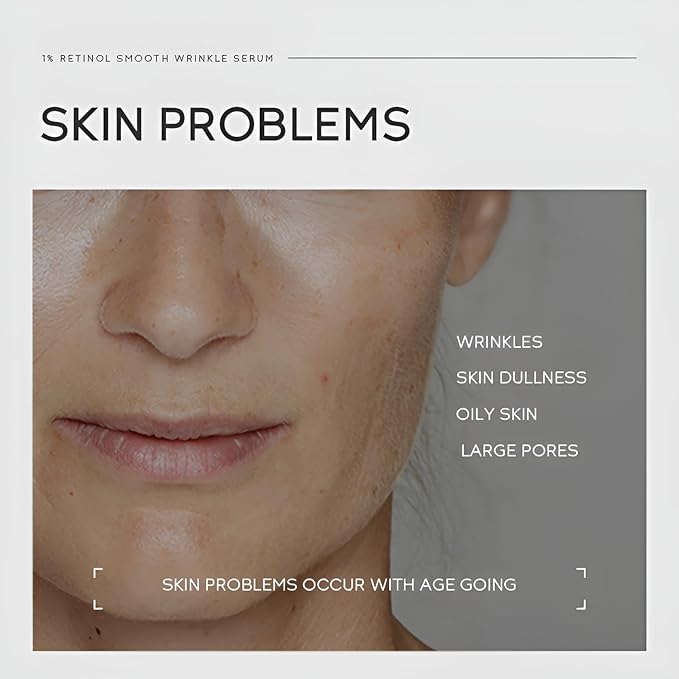 1% Retinol Serum for Face, Facial Serums for Anti Aging with Retinol, Niacinamide & Vitamin E for Fine Lines, Wrinkles & Dark Spots, Daily Skincare to Smooth & Firm Skin, 1.06 fl. oz, Pack of 2-GlimoraGlow