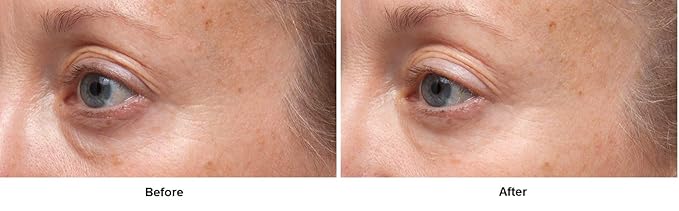 Dr. Dennis Gross Ferulic + Retinol Triple Correction Eye Serum: for Wrinkles, Loss of Elasticity, and Rough Texture, 0.5 fl oz-GlimoraGlow