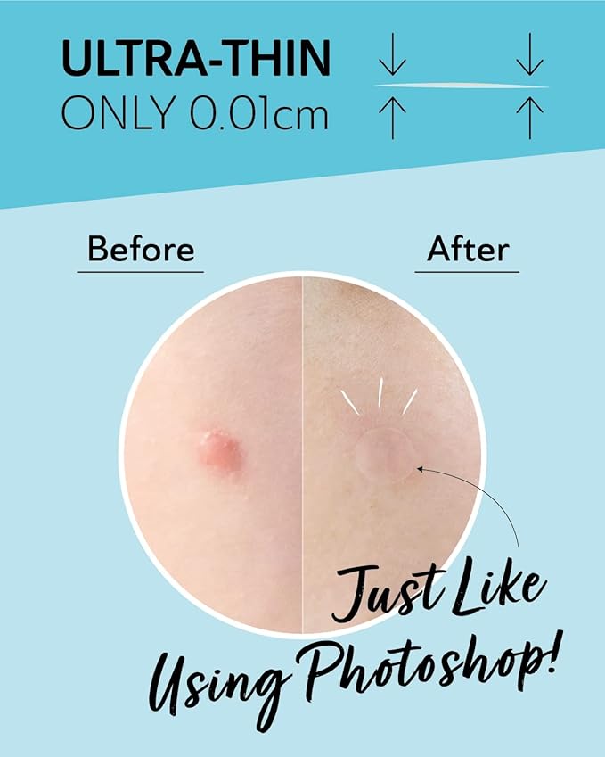 Invisible Salicylic Acid Pimple Patches for Face - Redness Reducing Hydrocolloid Acne Patches, Clear Pimple & Zit Patches for Blind Pimples - Soothing Plus (Clear Patch) (Intensive-36dots-2)-GlimoraGlow