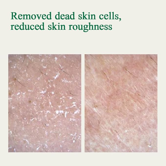 Pyunkang Yul PKY Ultimate Calming Solution Ampoule for Sensitive Skin with Patented Ingredients, Serum Intensely Calms & Soothes Redness with Cica & Tea Tree, Korean Skincare (1.01 Fl. Oz, 30ml)-GlimoraGlow