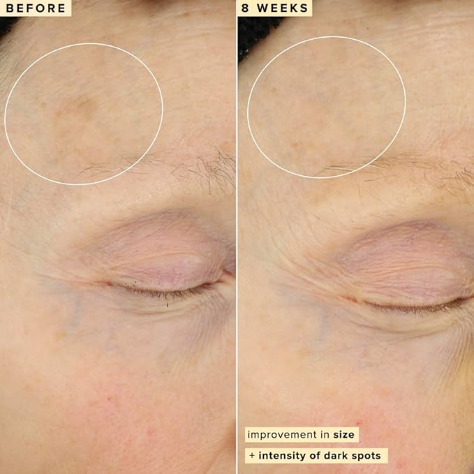 Farmacy 10% Vitamin C Serum for Face - Brightening Vitamin C Face Serum to Firm + Smooth Skin Texture - L Ascorbic Acid + Tangerine Peel Infused Skin Care to Hydrate and Even Skin Tone (30ml)-GlimoraGlow