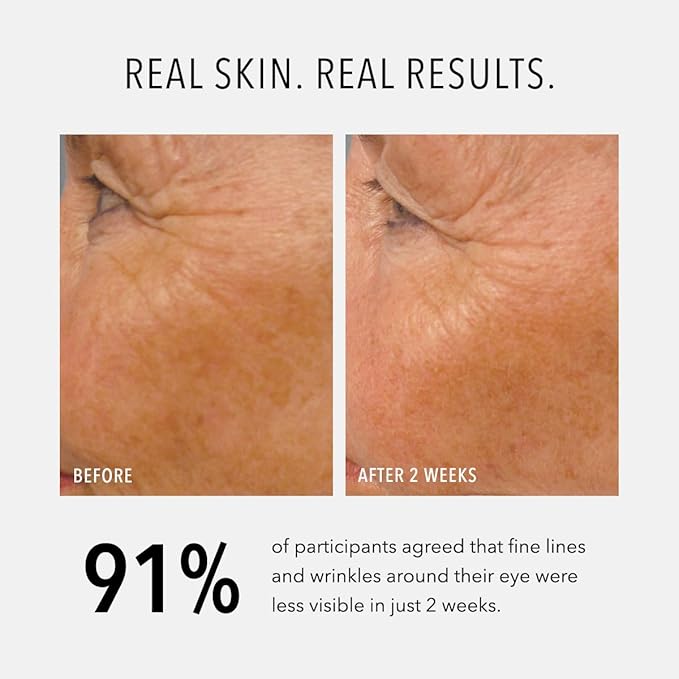 HydroPeptide LumaPro-C Face Serum, Peptide & Pigment Complexion Corrector, Nourish Skin, 1 Ounce-GlimoraGlow