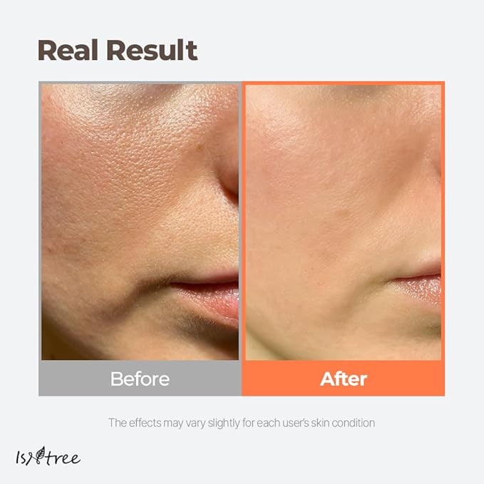 ISNTREE Green Tea Fresh Toner 200ml, 6.76 fl.oz | Korean Skincare | Toner for Oily Skin | Sebum Control | Hydrating and Refreshing-GlimoraGlow