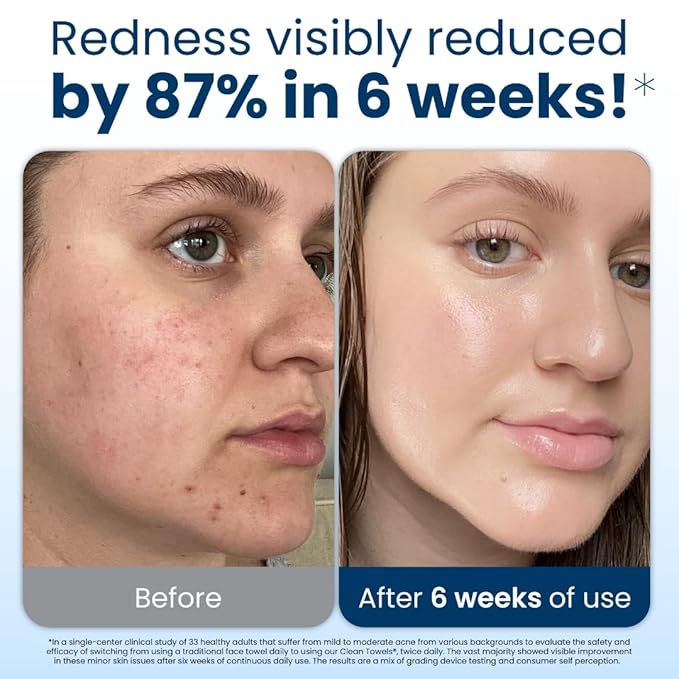 Clean Skin Club Clean Towels XL, USDA Certified 100‪%‬ Biobased Dermatologist Approved Disposable Face Towelette, Facial Washcloth, Makeup Remover Dry Wipes, Ultra Soft, 150 count, 3 pack-GlimoraGlow