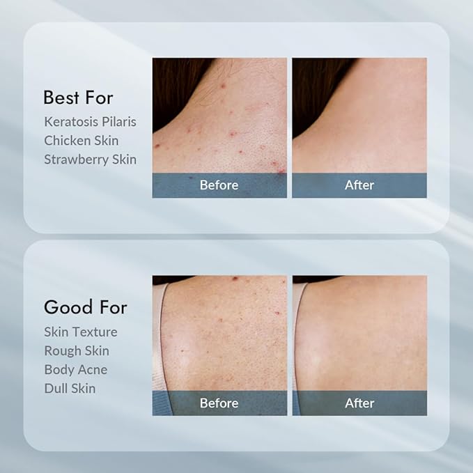 V11FACTORY AHA 12% Glycolic Acid Body Lotion – Korean Exfoliating & Hydrating Body Cream with Hyaluronic Acid & Collagen – Unscented, Paraben-Free Skin Smoothing Moisturizer, 10.6 oz-GlimoraGlow