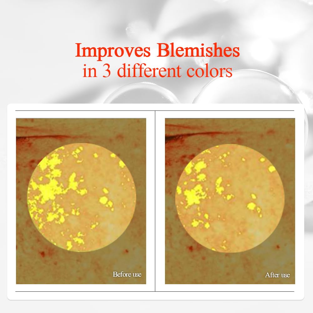 Pyunkang Yul PKY Radiance Vita Serum, 1 Fluid Ounce – Hydrating Serum for Dry Skin with Hyaluronic Acid, Niacinamide, Panthenol, Pearl Extract, 24-Hour Moisturizing and Elasticity Care, EWG Green-GlimoraGlow