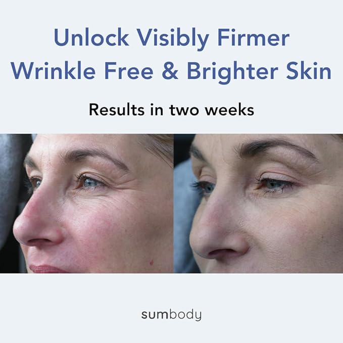 Natural Under Eye Cream Age Defying Plant-Based Retinol Alternative Vegan Eye Repair Moisturizer with Caffeine, antioxidants, Green & white Tea-Prevents Under-eye Wrinkles, Puffiness, Eye Bags-GlimoraGlow