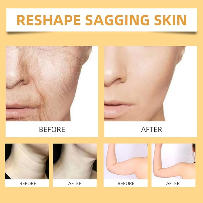 Bee Venom Firming Serum Stick, 2PCS Anti-Aging Face Cream, Lifts and Tightens the Skin, Hydrating, Lifting & Restoring Skin Elasticity, Bee Venom Body Tightening Cream for Women & Men-GlimoraGlow