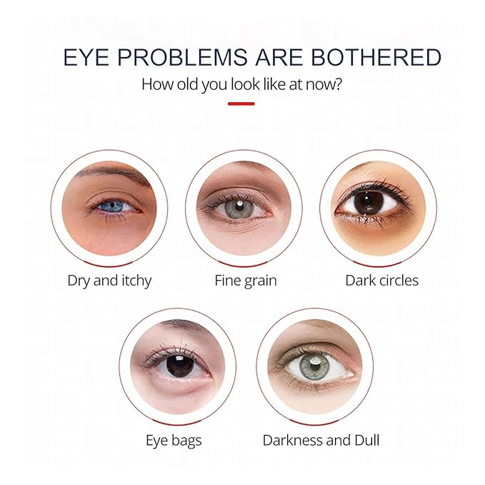 Open eyes awaken peptide lifting eye gel,peptide eye lifting gel,Reduces Dark Circles, Dark circles Hydrating firming Eye cream (5PCS)-GlimoraGlow