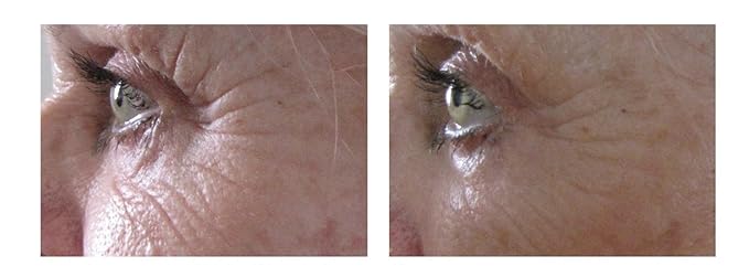 Airelle Age-Defying Eye and Lip Treatment | Anti Aging, Helps Reduce Wrinkles, Fine Lines | Dermatologist Recommended | Hyaluronic Acid, Berrimatrix | Natural Ingredients | .3 Fl Oz-GlimoraGlow