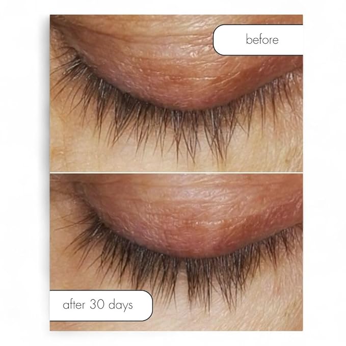 Serious Skincare Lash Bath & Conditioner - Double Action Eye Makeup Remover - Oil Free - Enhancing Peptides Promotes Eyelash Growth - Clover Flower - Effortlessly Removes Waterproof Mascara - 4 oz.-GlimoraGlow