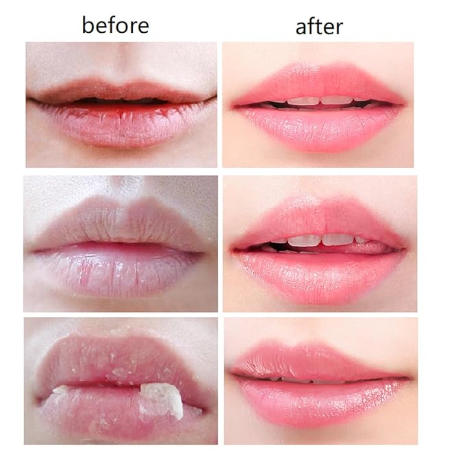 2 PCS Bee Lip Balm Honey Pot,Honey Lip Mask,Honey Propolis Lip Mask Moisturizing Moisture Nourishing Dry & Chapped Lips,Lip Care and Reduces Lip Lines-GlimoraGlow