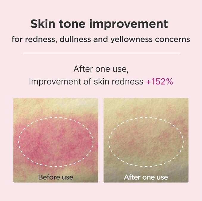 ISOI Blemish Care Up Serum Gift Set, Korean Skin Care for Hydration & Radiance – Full Size or 5-Step Travel Kit Options (5-Step Special Kit (1.77 fl.oz))-GlimoraGlow