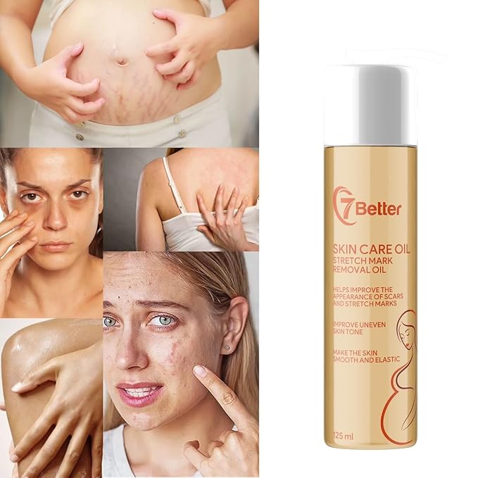 Stretch Mark Pregnancy Oil, Natural Oil Skincare Body Oil Serum for Scars and Stretch Marks, Face with Vitamin E & A for Sensitive Dry Skin and Body Moisturizer-GlimoraGlow
