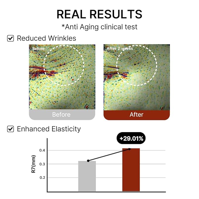 Mito-on Cell Rejuvenation Anti-Aging Serum, 30ml / 1.01 fl.oz –10% Niacinamide, Vitamin B3 and Antioxidants, Centella + EGF for Anti-Aging, Wrinkle Reduction, Pore minimization, Korean Skin Care-GlimoraGlow