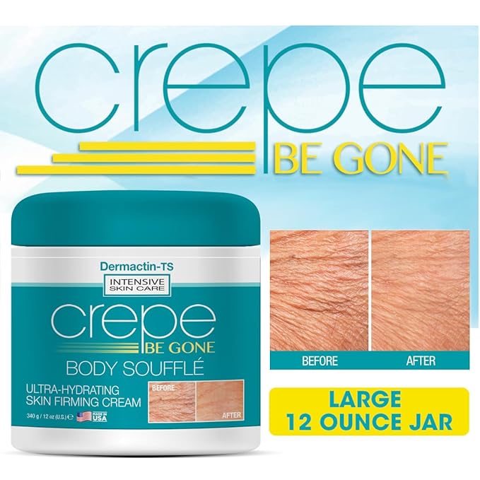 Crepe Be Gone Body Souffle Classic - Large 12 ounce - Ultra Hydrating Crepe Skin Firming Cream for Neck,Chest, Arms & Legs-GlimoraGlow