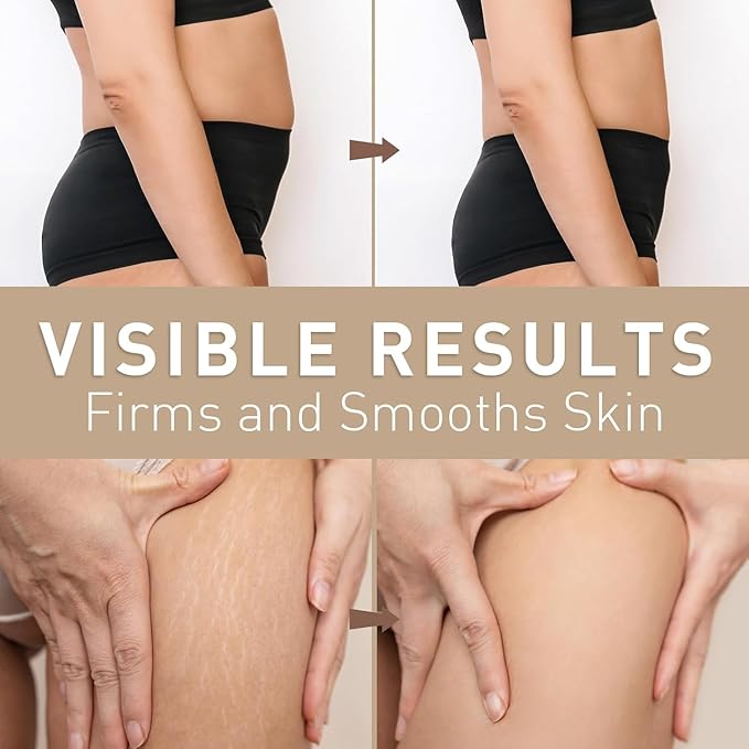 Belly Firming Cream for Tightening & Cellulite – Skin Firming Cream for Stomach, Thighs & Butt – Moisturizing & Lifting Body Lotion for Women-GlimoraGlow